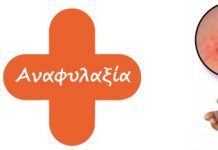 Πρακτικές οδηγίες για την αντιμετώπιση αναφυλαξίας