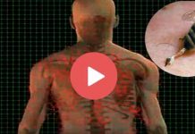 Δείτε πως αντιδρά ο οργανισμός μας στο τσίμπημα της μέλισσας! (3D Βίντεο)