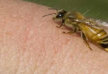 Τι κάνουμε μετά την εμφάνιση αλλεργικής αντίδρασης απο τσίμπημα μέλισσας