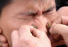 Πού πονάει περισσότερο το τσίμπημα της μέλισσας;